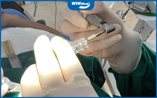Implant Hàn Quốc có gì đặc biệt Implant Hàn Quốc có gì đặc biệt