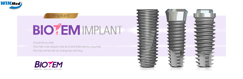 Top 4 Implant giá tốt chất lượng ổn