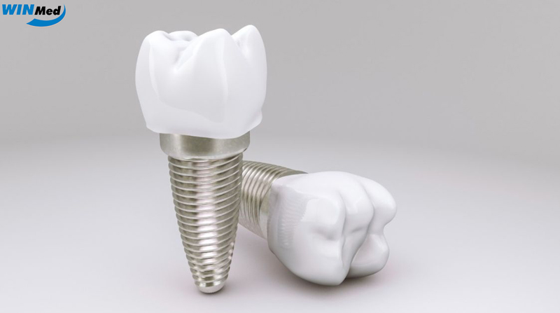 Trồng răng Implant bền rẻ? Có hay không?