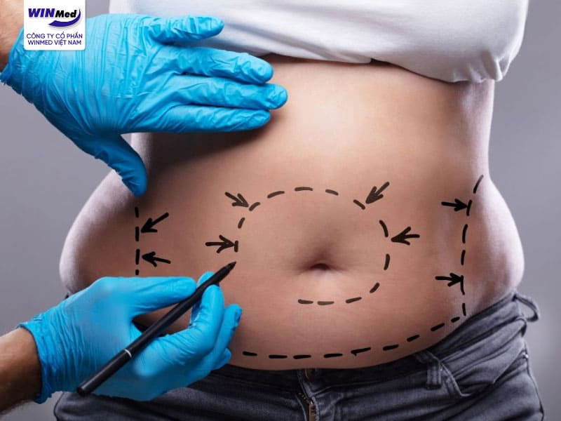 Ưu Điểm Của Công Nghệ Body Jet