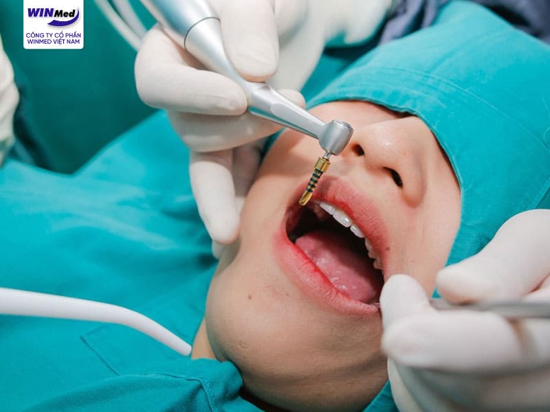 Trồng răng Implant là phương pháp phục hình răng ra đời từ sớm