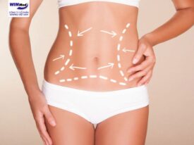 SO SÁNH PHƯƠNG PHÁP HÚT MỠ TRUYỀN THỐNG VÀ CÔNG NGHỆ HÚT MỠ BODY JET
