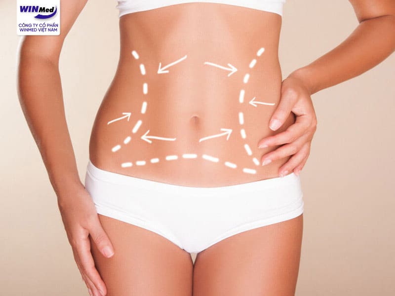 SO SÁNH PHƯƠNG PHÁP HÚT MỠ TRUYỀN THỐNG VÀ CÔNG NGHỆ HÚT MỠ BODY JET