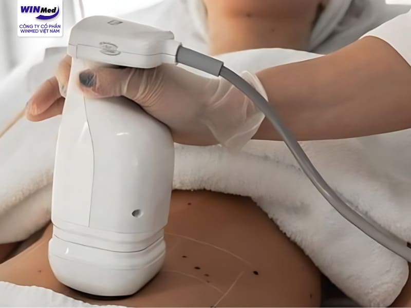 Máy hút mỡ Liposonix – Giải pháp không phẫu thuật