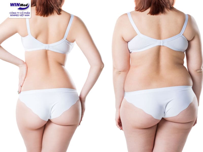 Body Jet hoạt động bằng áp lực tia nước để tách và loại bỏ mô mỡ một cách nhẹ nhàng