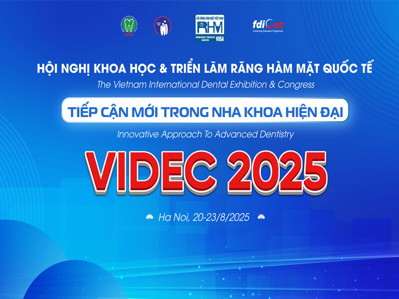 Chương trình Tiền Hội nghị