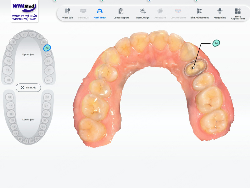 Aoralscan L là giải pháp nâng cao chất lượng điều trị và trải nghiệm cho bệnh nhân