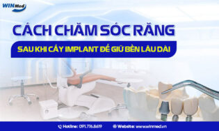 CÁCH CHĂM SÓC RĂNG SAU KHI CẤY IMPLANT ĐỂ GIỮ BỀN LÂU DÀI