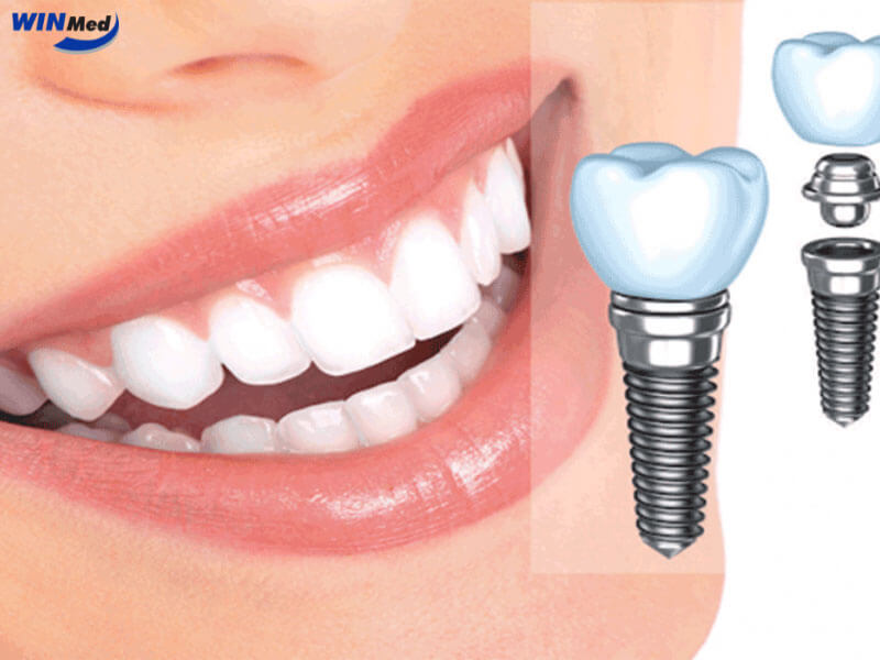 Hướng dẫn vệ sinh răng miệng đúng cách