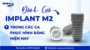 ĐÁNH GIÁ IMPLANT M2 TRONG CÁC CA PHỤC HÌNH RĂNG HIỆN NAY