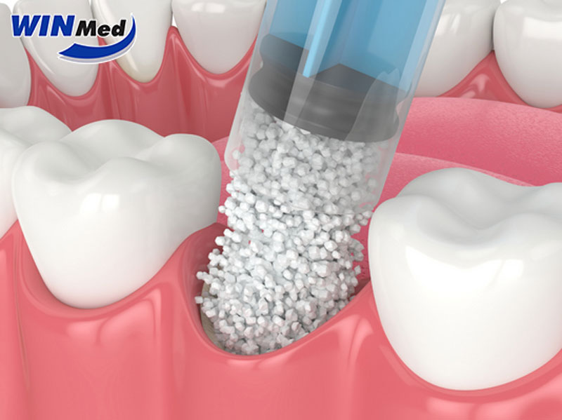 Vì sao nên lựa chọn OSTEON Xeno do Winmed phân phối?