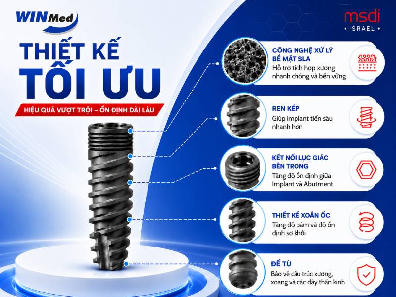 Những ưu điểm nổi bật của Implant MSDI