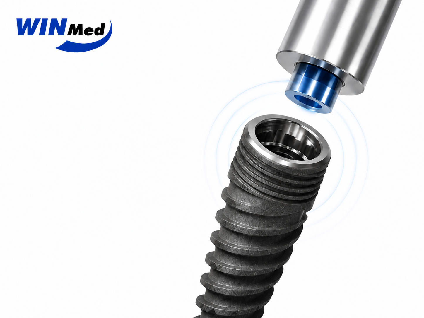 Lựa chọn hệ thống Implant phù hợp là một phần trong quá trình xây dựng kế hoạch điều trị.
